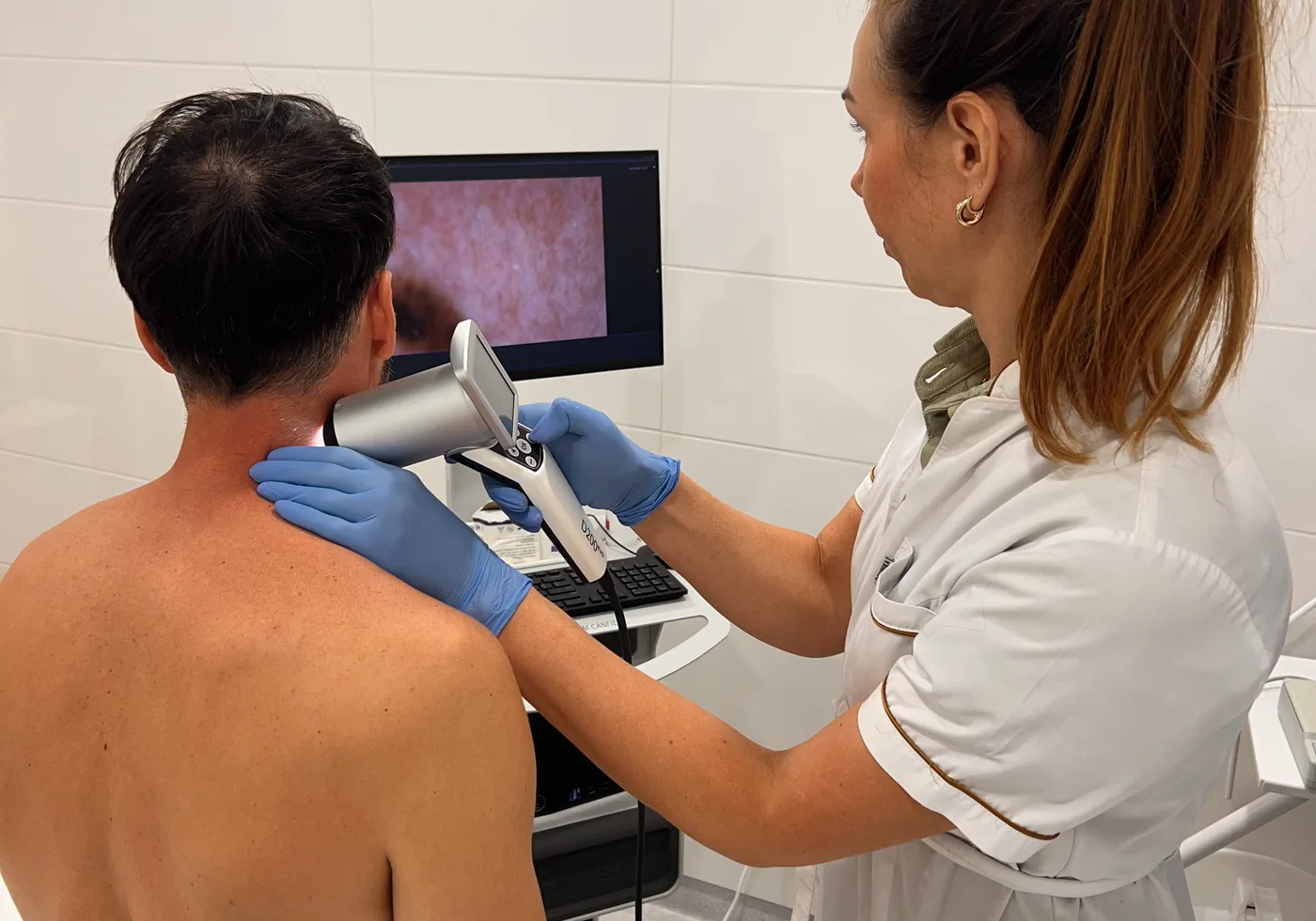 Wideodermatoskopia i badanie znamion w Clinica Dermatologica w Gdańsku